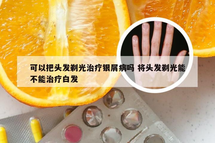 可以把头发剃光治疗银屑病吗 将头发剃光能不能治疗白发