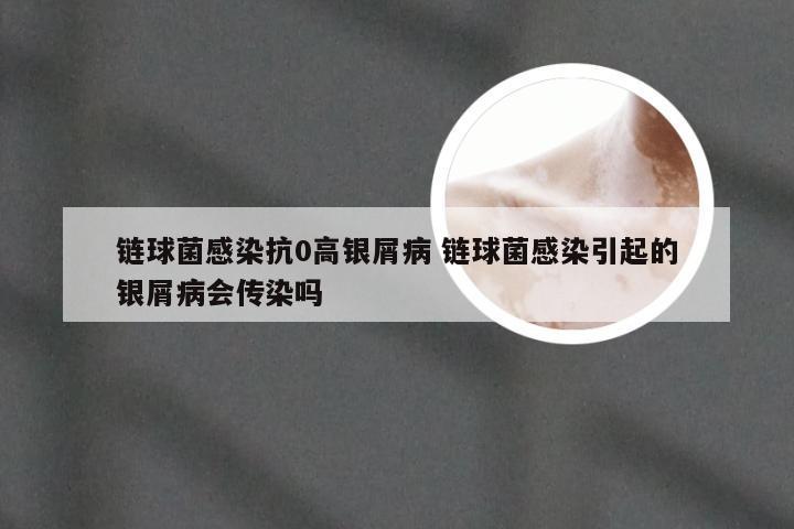 链球菌感染抗0高银屑病 链球菌感染引起的银屑病会传染吗
