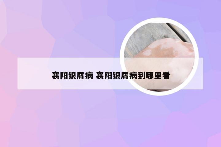 襄阳银屑病 襄阳银屑病到哪里看