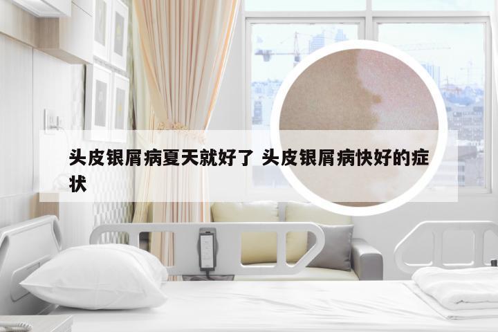 头皮银屑病夏天就好了 头皮银屑病快好的症状