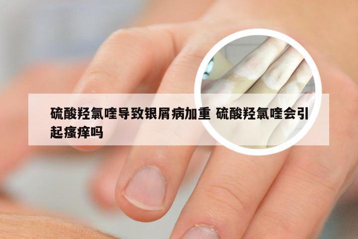 硫酸羟氯喹导致银屑病加重 硫酸羟氯喹会引起瘙痒吗