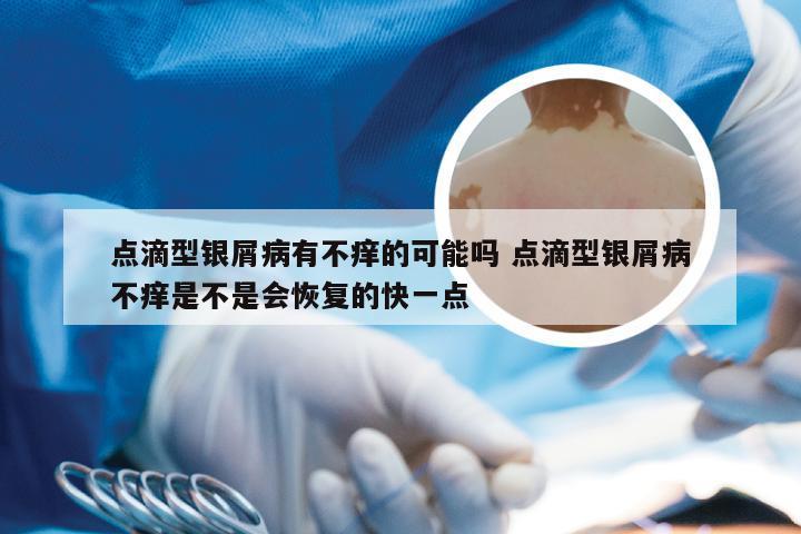 点滴型银屑病有不痒的可能吗 点滴型银屑病不痒是不是会恢复的快一点