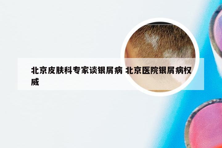 北京皮肤科专家谈银屑病 北京医院银屑病权威