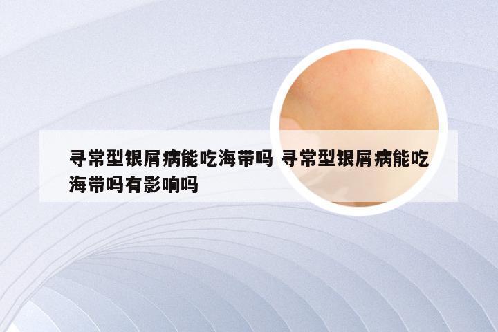 寻常型银屑病能吃海带吗 寻常型银屑病能吃海带吗有影响吗