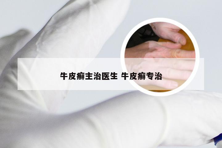 牛皮癣主治医生 牛皮癣专治