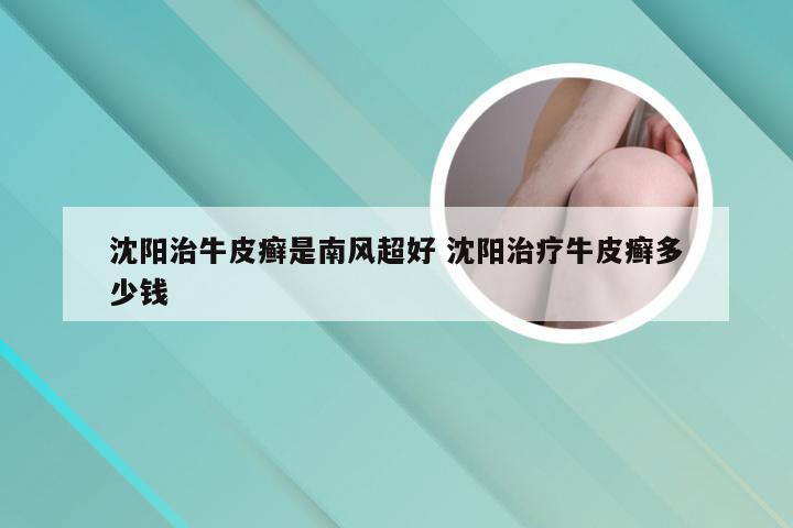 沈阳治牛皮癣是南风超好 沈阳治疗牛皮癣多少钱