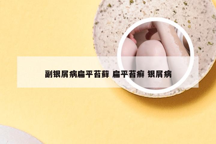 副银屑病扁平苔藓 扁平苔癣 银屑病