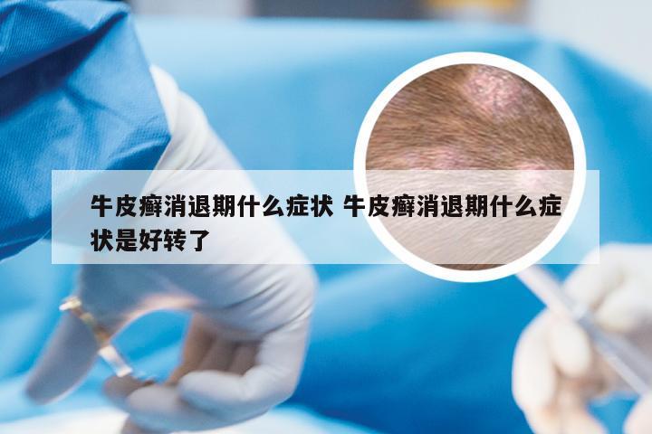 牛皮癣消退期什么症状 牛皮癣消退期什么症状是好转了