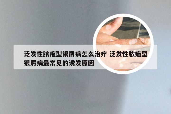 泛发性脓疱型银屑病怎么治疗 泛发性脓疱型银屑病最常见的诱发原因