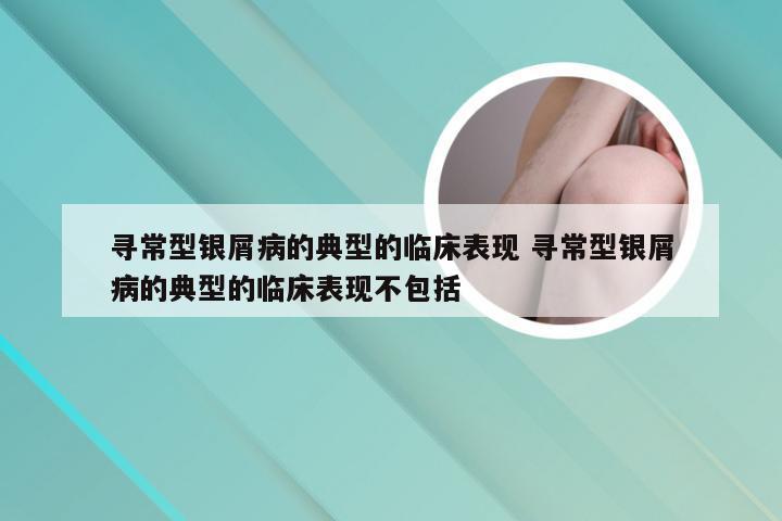 寻常型银屑病的典型的临床表现 寻常型银屑病的典型的临床表现不包括