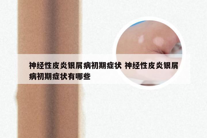 神经性皮炎银屑病初期症状 神经性皮炎银屑病初期症状有哪些