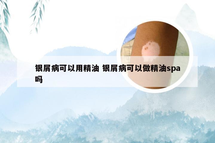 银屑病可以用精油 银屑病可以做精油spa吗