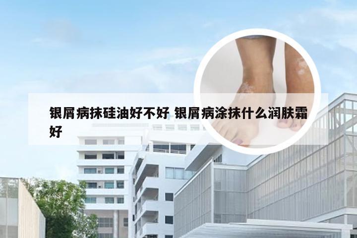 银屑病抹硅油好不好 银屑病涂抹什么润肤霜好