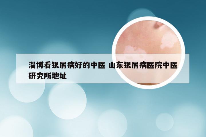 淄博看银屑病好的中医 山东银屑病医院中医研究所地址
