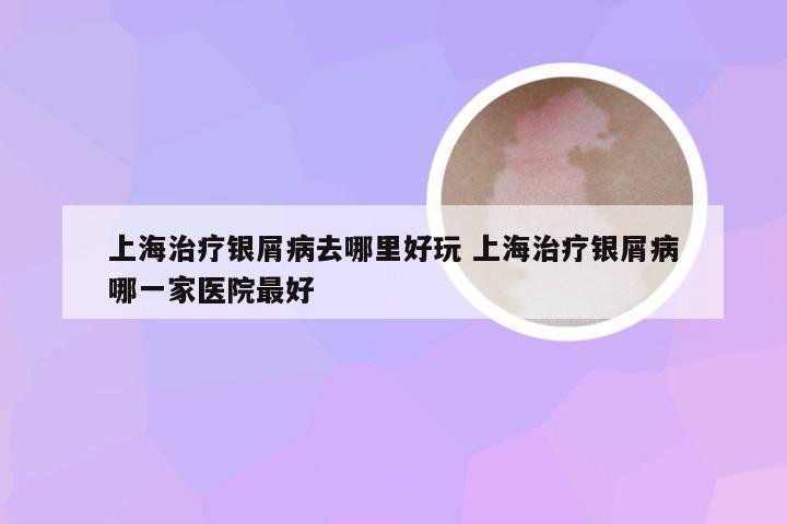 上海治疗银屑病去哪里好玩 上海治疗银屑病哪一家医院最好