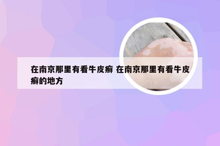 在南京那里有看牛皮癣 在南京那里有看牛皮癣的地方