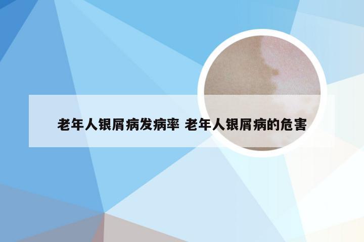 老年人银屑病发病率 老年人银屑病的危害
