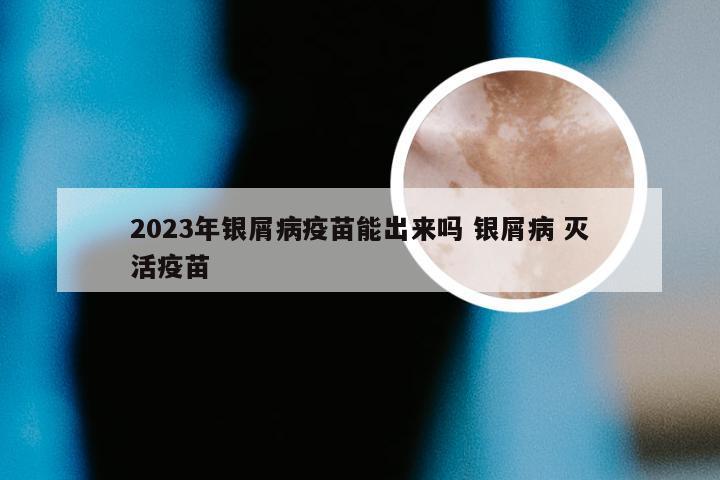 2023年银屑病疫苗能出来吗 银屑病 灭活疫苗