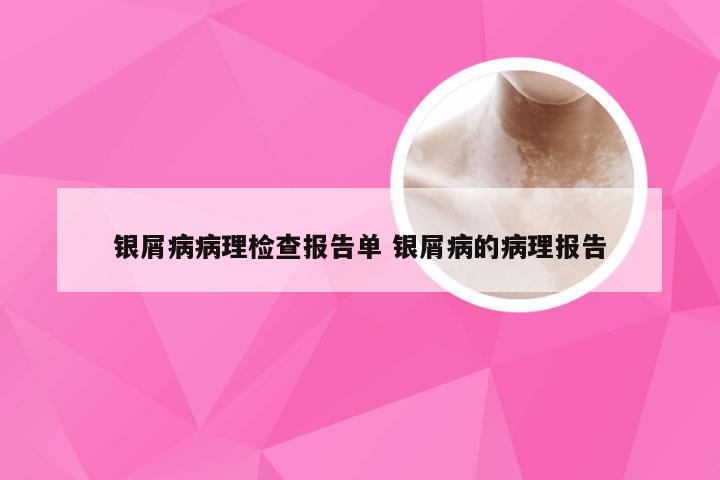 银屑病病理检查报告单 银屑病的病理报告