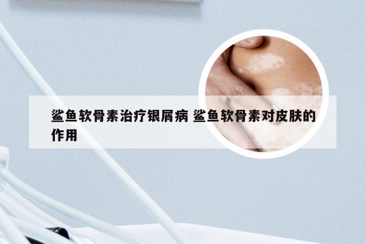 鲨鱼软骨素治疗银屑病 鲨鱼软骨素对皮肤的作用