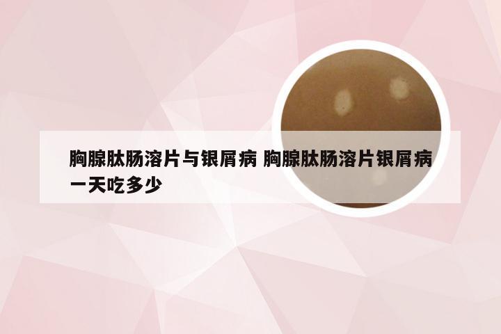 胸腺肽肠溶片与银屑病 胸腺肽肠溶片银屑病一天吃多少
