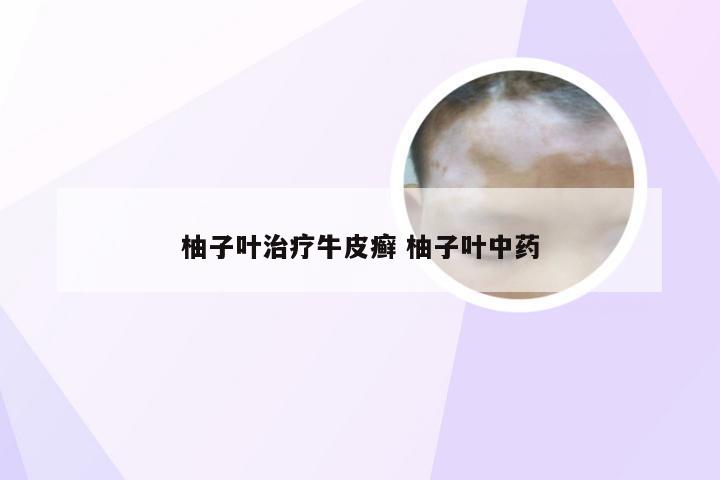 柚子叶治疗牛皮癣 柚子叶中药