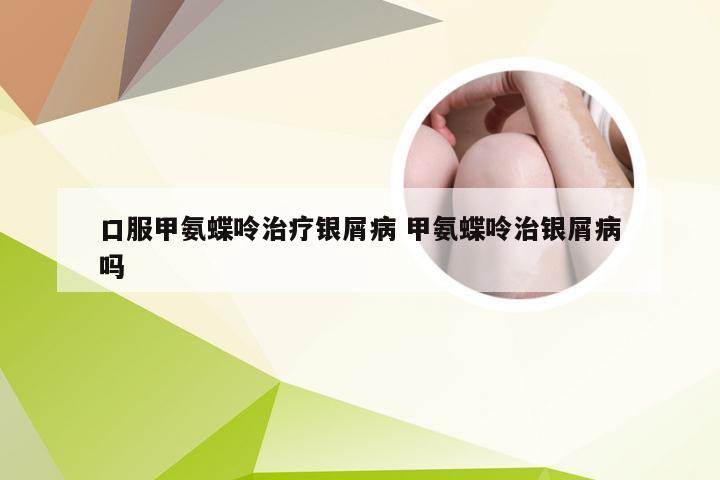 口服甲氨蝶呤治疗银屑病 甲氨蝶呤治银屑病吗