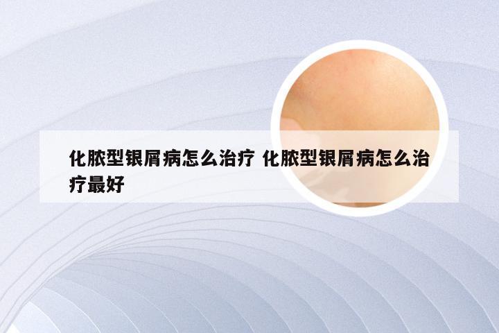 化脓型银屑病怎么治疗 化脓型银屑病怎么治疗最好