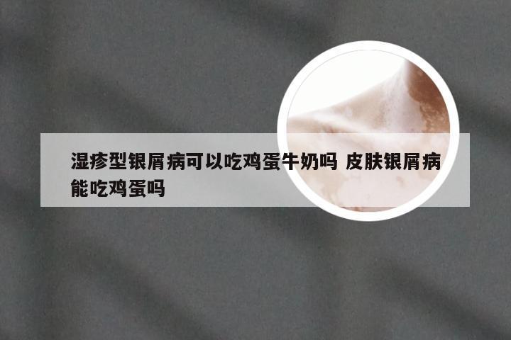 湿疹型银屑病可以吃鸡蛋牛奶吗 皮肤银屑病能吃鸡蛋吗