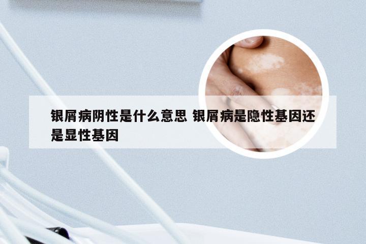 银屑病阴性是什么意思 银屑病是隐性基因还是显性基因