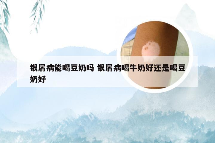 银屑病能喝豆奶吗 银屑病喝牛奶好还是喝豆奶好