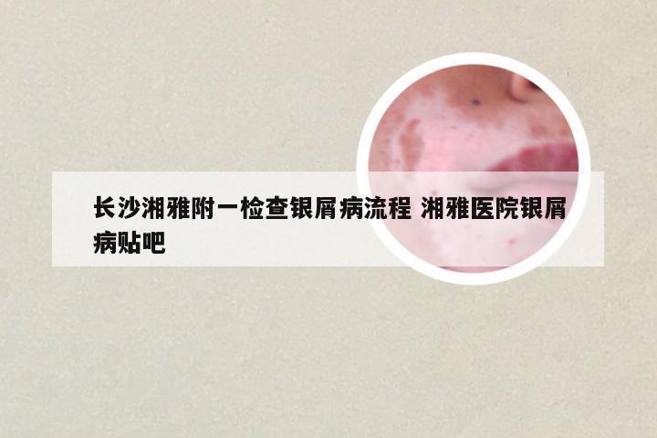 长沙湘雅附一检查银屑病流程 湘雅医院银屑病贴吧