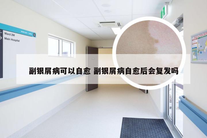 副银屑病可以自愈 副银屑病自愈后会复发吗