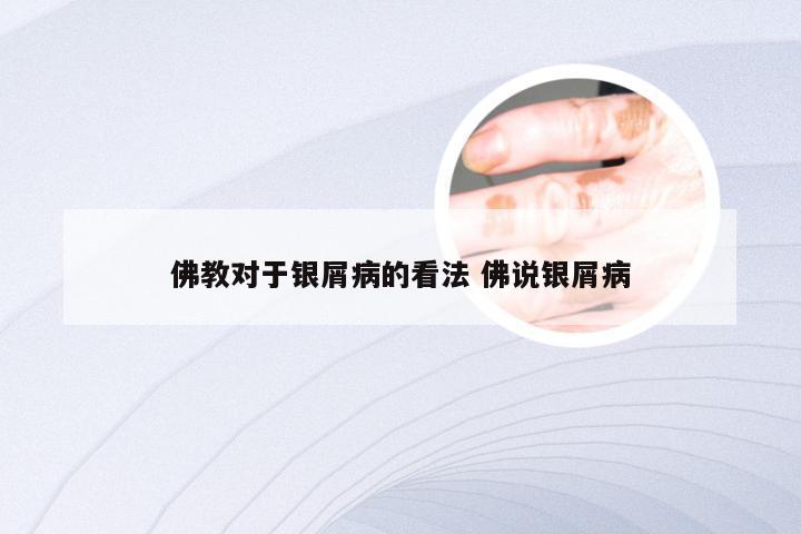 佛教对于银屑病的看法 佛说银屑病