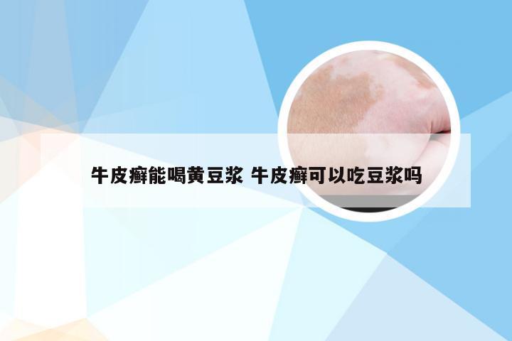 牛皮癣能喝黄豆浆 牛皮癣可以吃豆浆吗