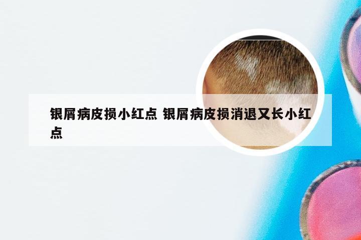 银屑病皮损小红点 银屑病皮损消退又长小红点
