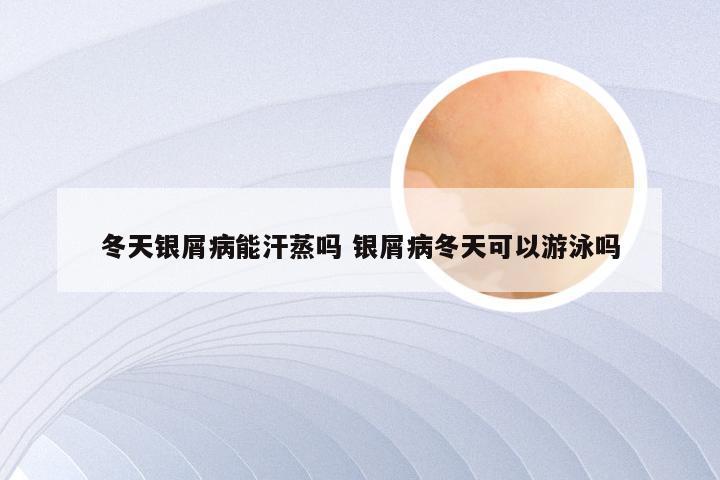 冬天银屑病能汗蒸吗 银屑病冬天可以游泳吗