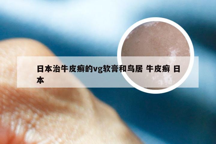 日本治牛皮癣的vg软膏和鸟居 牛皮癣 日本