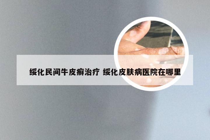 绥化民间牛皮癣治疗 绥化皮肤病医院在哪里