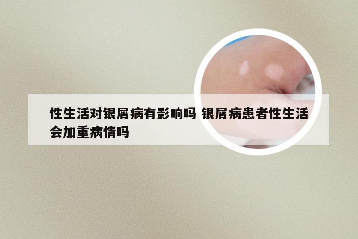 性生活对银屑病有影响吗 银屑病患者性生活会加重病情吗