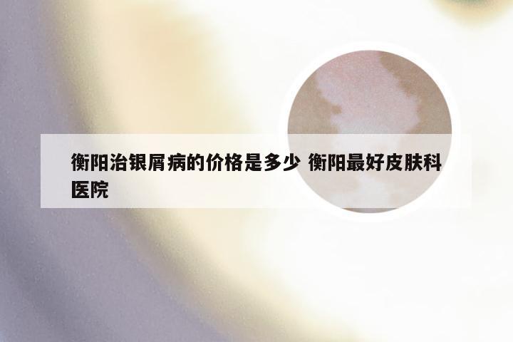 衡阳治银屑病的价格是多少 衡阳最好皮肤科医院