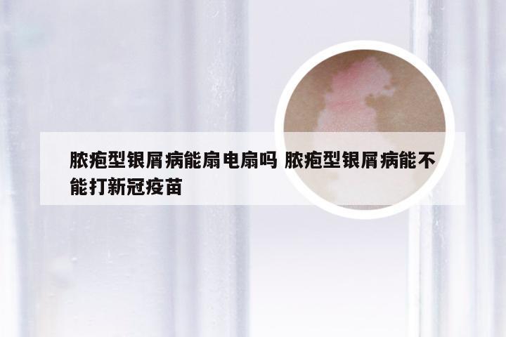 脓疱型银屑病能扇电扇吗 脓疱型银屑病能不能打新冠疫苗