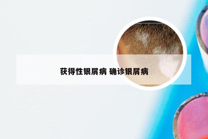 获得性银屑病 确诊银屑病