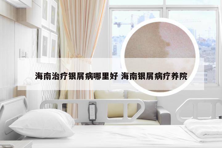 海南治疗银屑病哪里好 海南银屑病疗养院