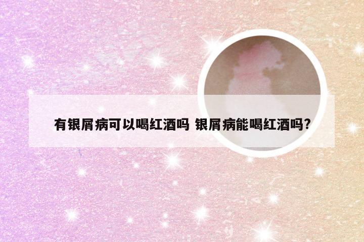 有银屑病可以喝红酒吗 银屑病能喝红酒吗?