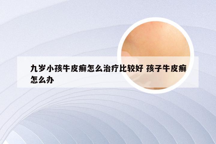 九岁小孩牛皮癣怎么治疗比较好 孩子牛皮癣怎么办