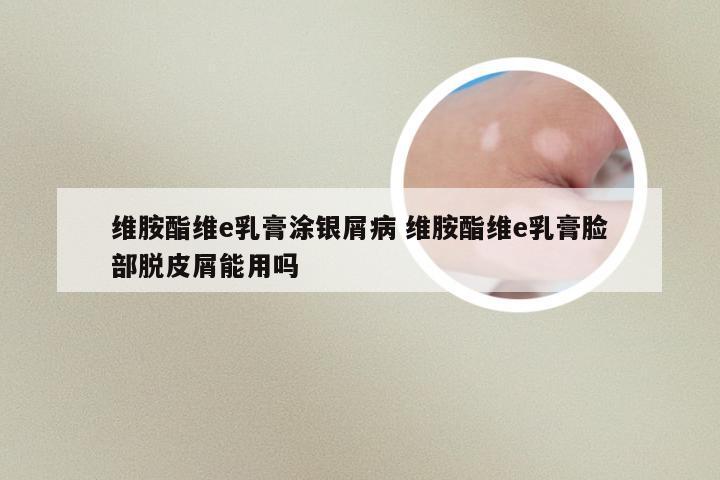 维胺酯维e乳膏涂银屑病 维胺酯维e乳膏脸部脱皮屑能用吗