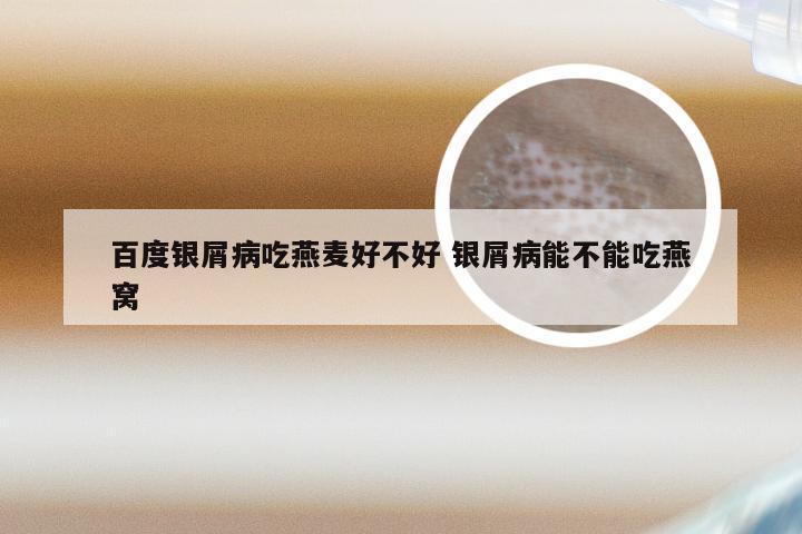 百度银屑病吃燕麦好不好 银屑病能不能吃燕窝