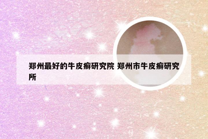 郑州最好的牛皮癣研究院 郑州市牛皮癣研究所