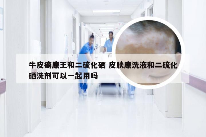 牛皮癣康王和二硫化硒 皮肤康洗液和二硫化硒洗剂可以一起用吗